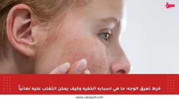 فرط تعرق الوجه: ما هي أسبابه الخفية وكيف يمكن التغلب عليه نهائياً